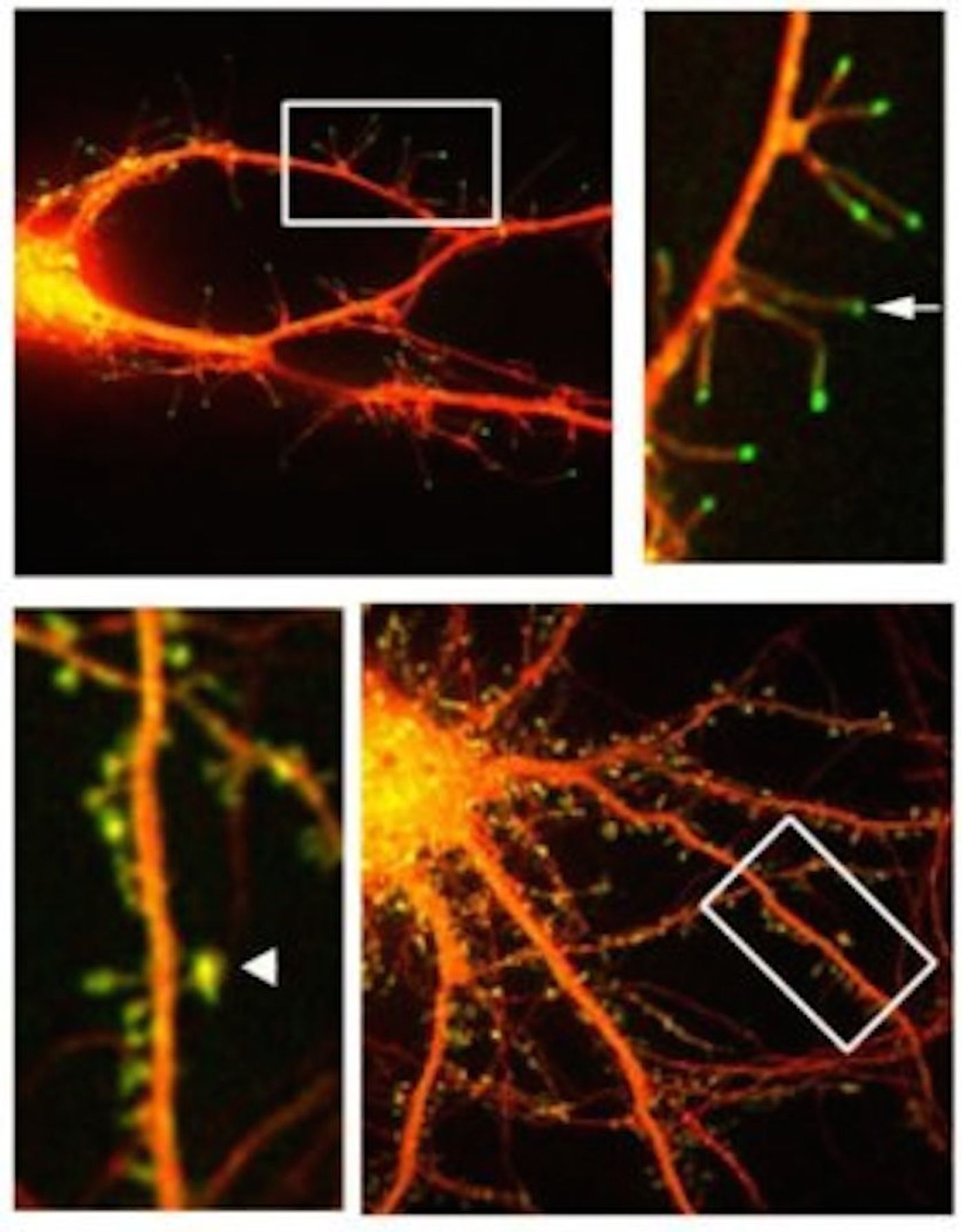 This is a fluorescent microphotograph of neurons that shows filapodia extending out from dendrite.