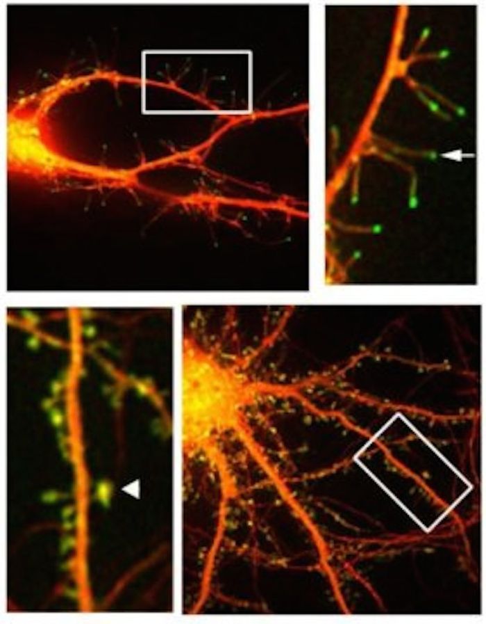 This is a fluorescent microphotograph of neurons that shows filapodia extending out from dendrite. This is a fluorescent microphotograph of neurons that shows filapodia extending out from dendrite.