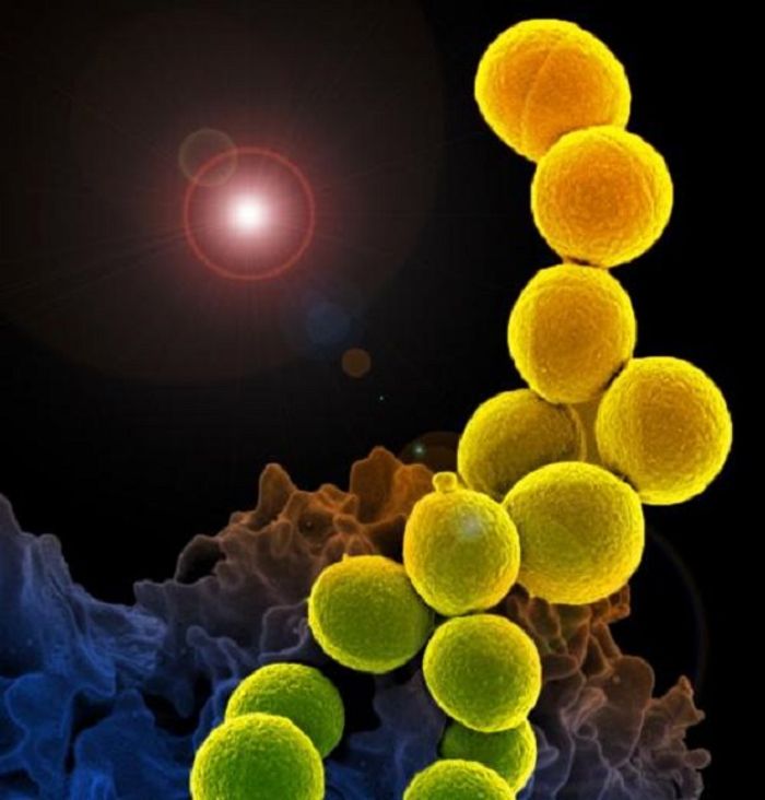 This is a colorized scanning electron micrograph of a white blood cell eating an antibiotic resistant strain of Staphylococcus aureus bacteria (MRSA). This is a colorized scanning electron micrograph of a white blood cell eating an antibiotic resistant strain of Staphylococcus aureus bacteria (MRSA).