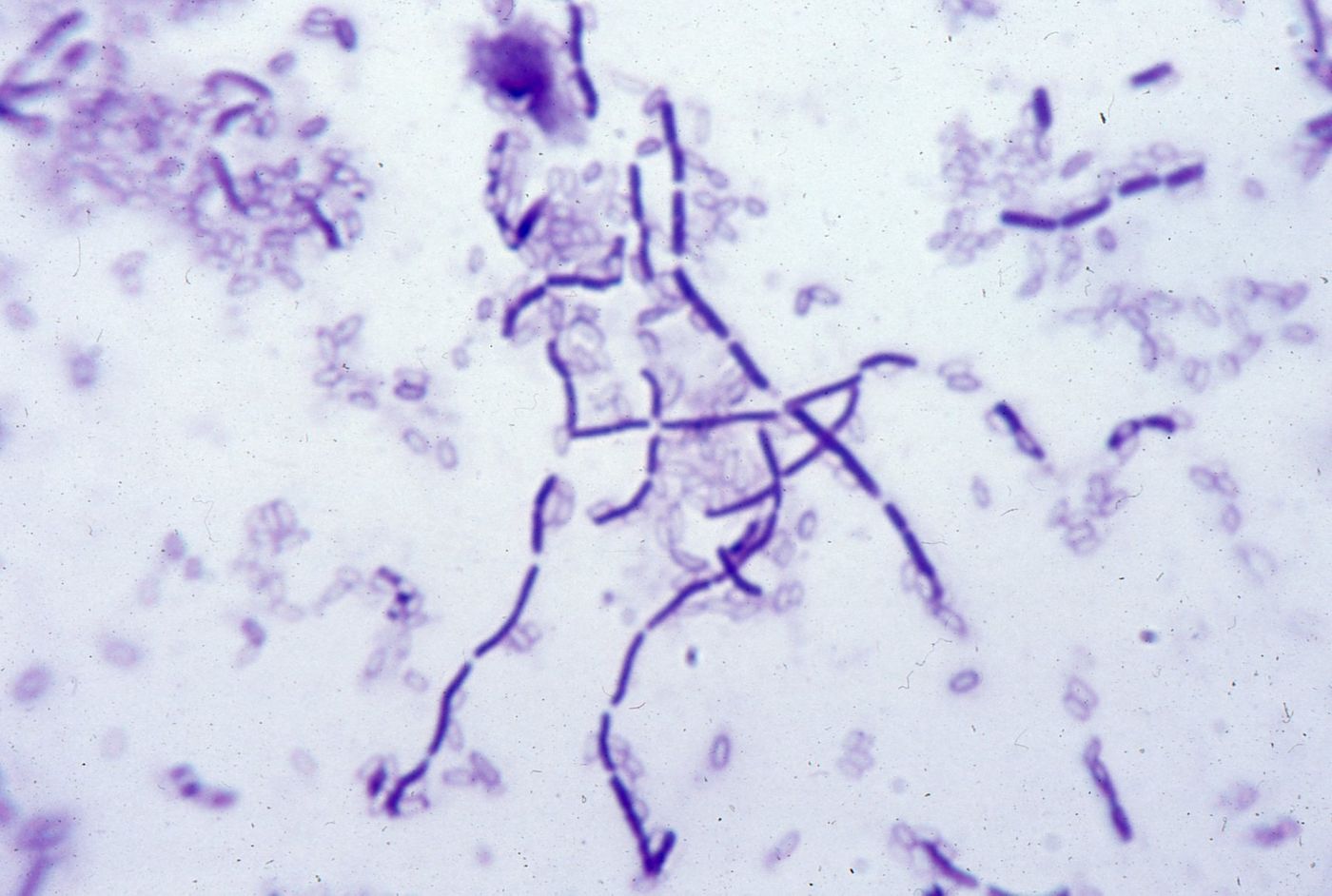 Bacillus subtilis is found in almost all soil types.