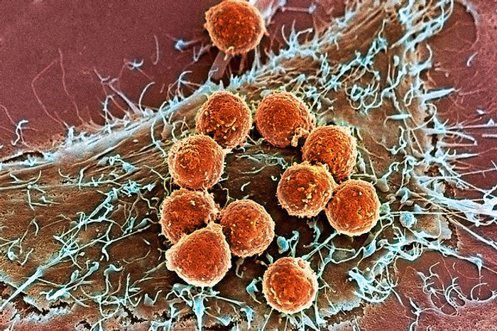Lasker Foundation gives awards for cancer treatment, DNA damage control and frontline responses to crises. Lasker Foundation gives awards for cancer treatment, DNA damage control and frontline responses to crises.