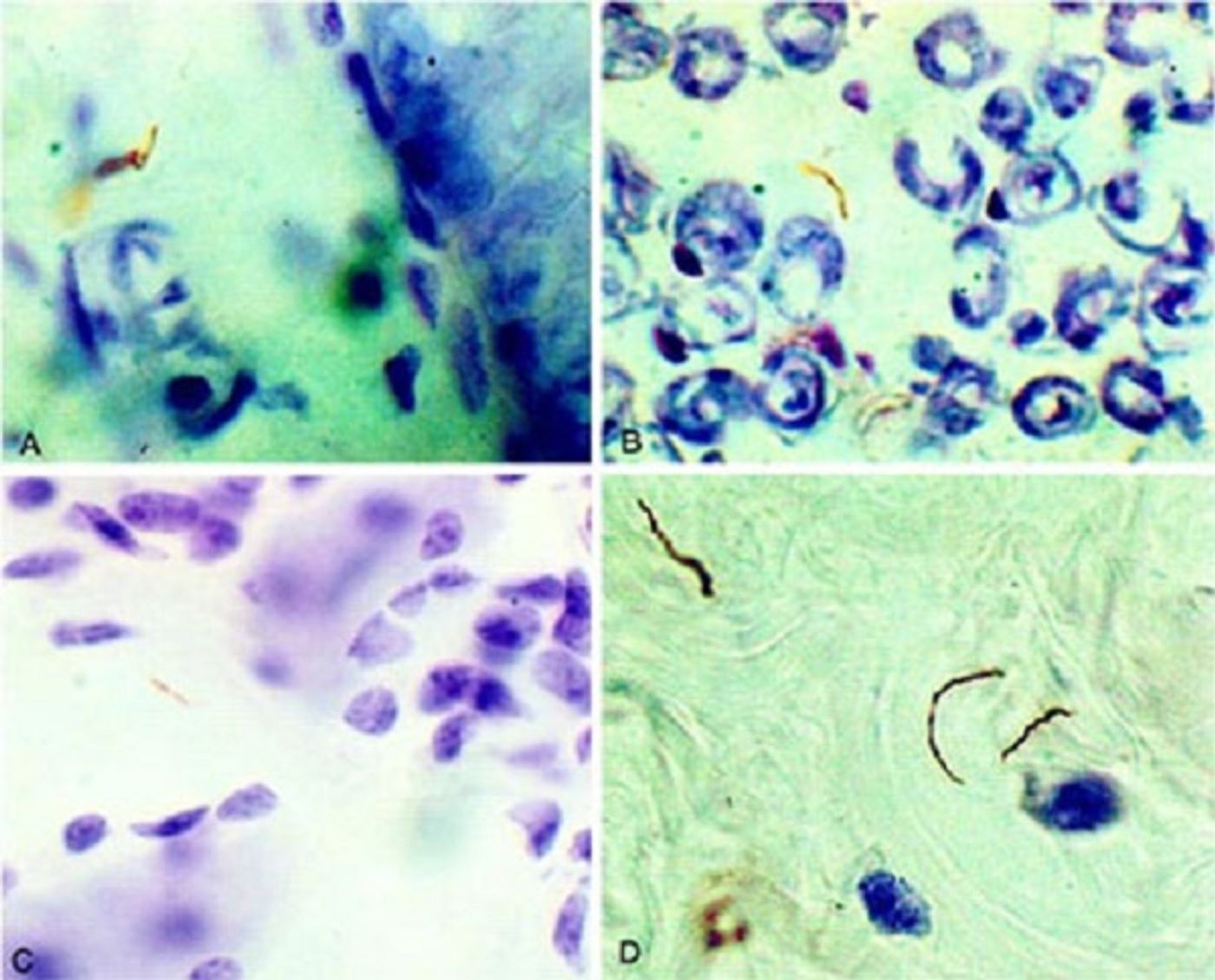 Microscopic images of Borrelia burgdorferi