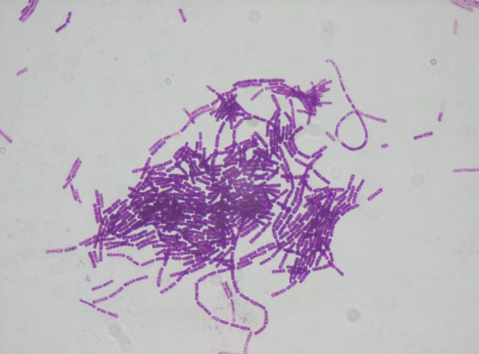 Gram stain of B. thuringiensis