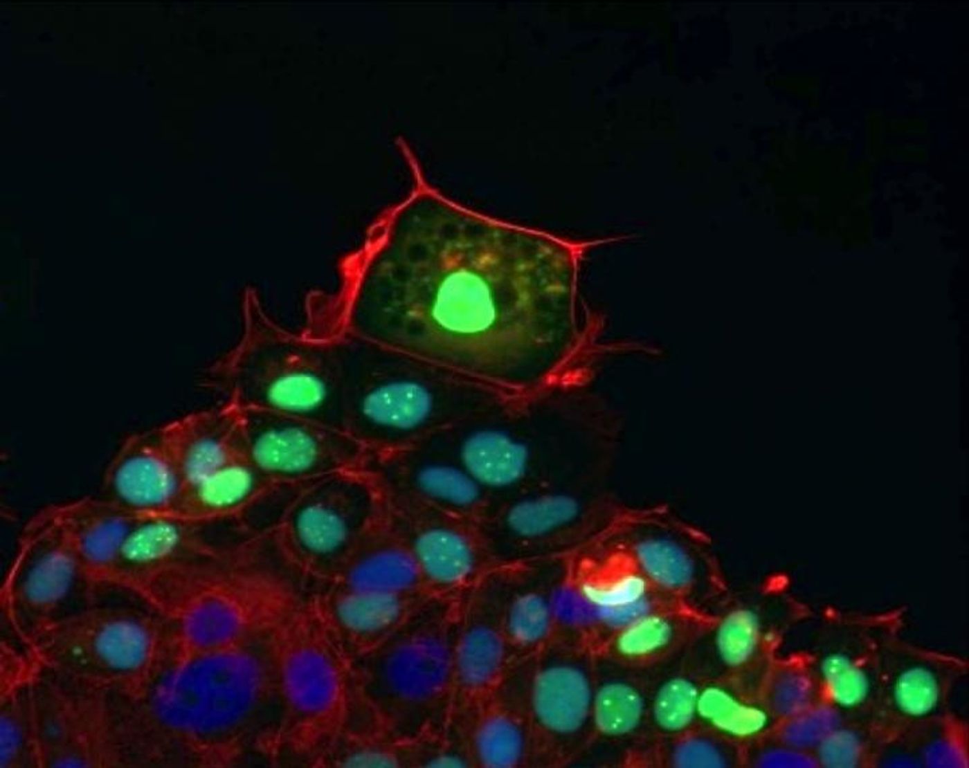 Leader cells, shown fluorescing green in this photomicrograph, pull follower cells in their wake as they move to cover and heal a wound.