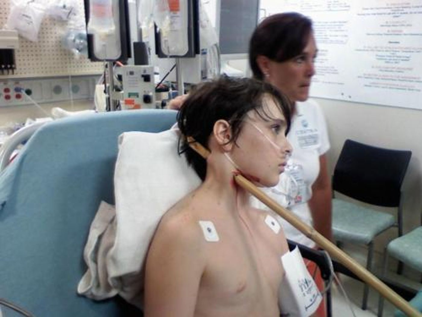13-Year-Old Boy Impaled With Large Bamboo Pole -- And Survives
