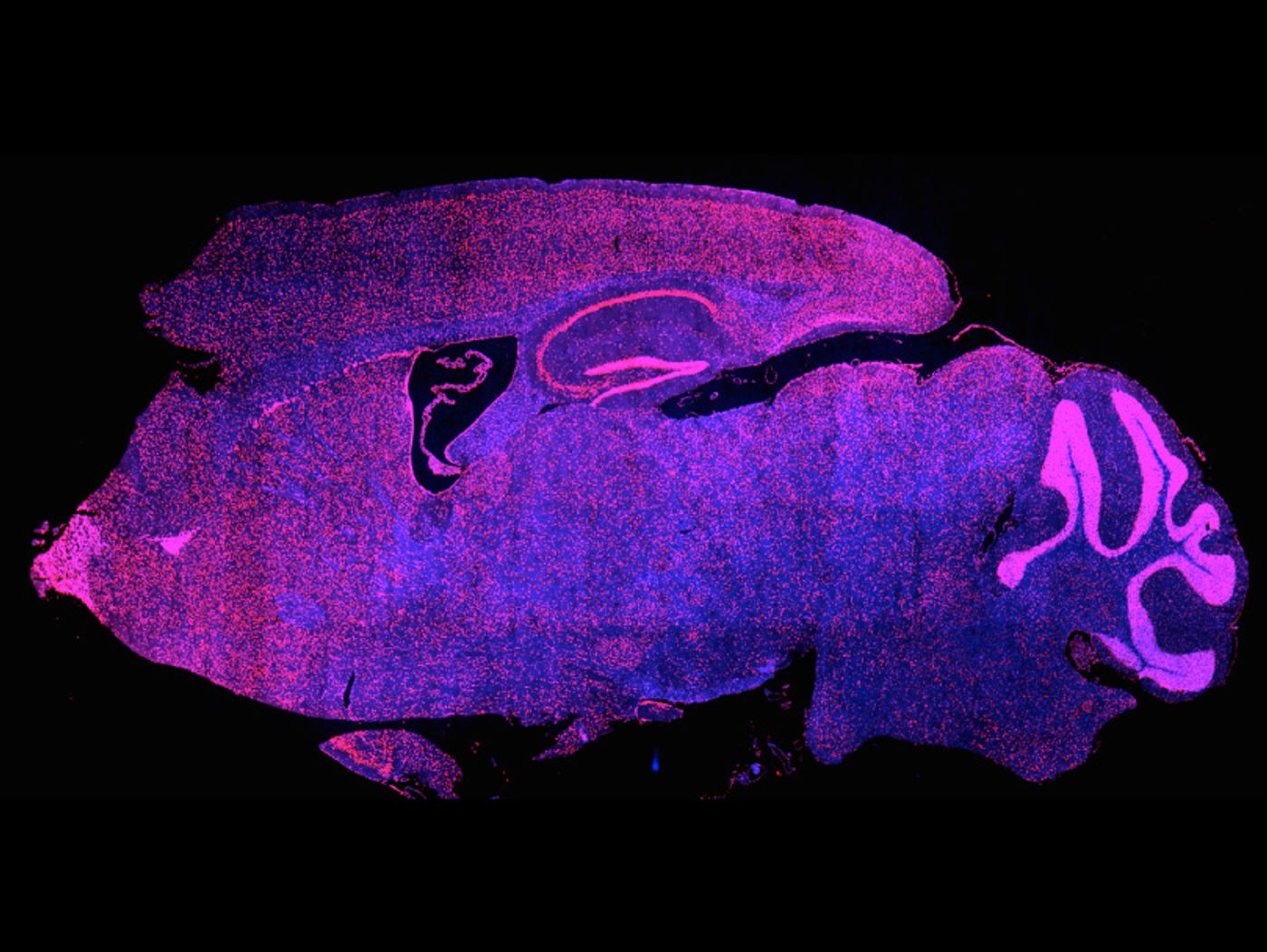 A striking brain presence: Neurons throughout the mouse brain produce Brd4, a protein targeted by some new cancer drugs. In this cross-section of a mouse brain, Brd4-producing cells are stained red but appear purple against a blue stain that labels all cells.