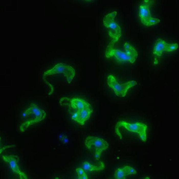 Microscopy image of Trypanosoma brucei, the African sleeping sickness parasite Microscopy image of Trypanosoma brucei, the African sleeping sickness parasite
