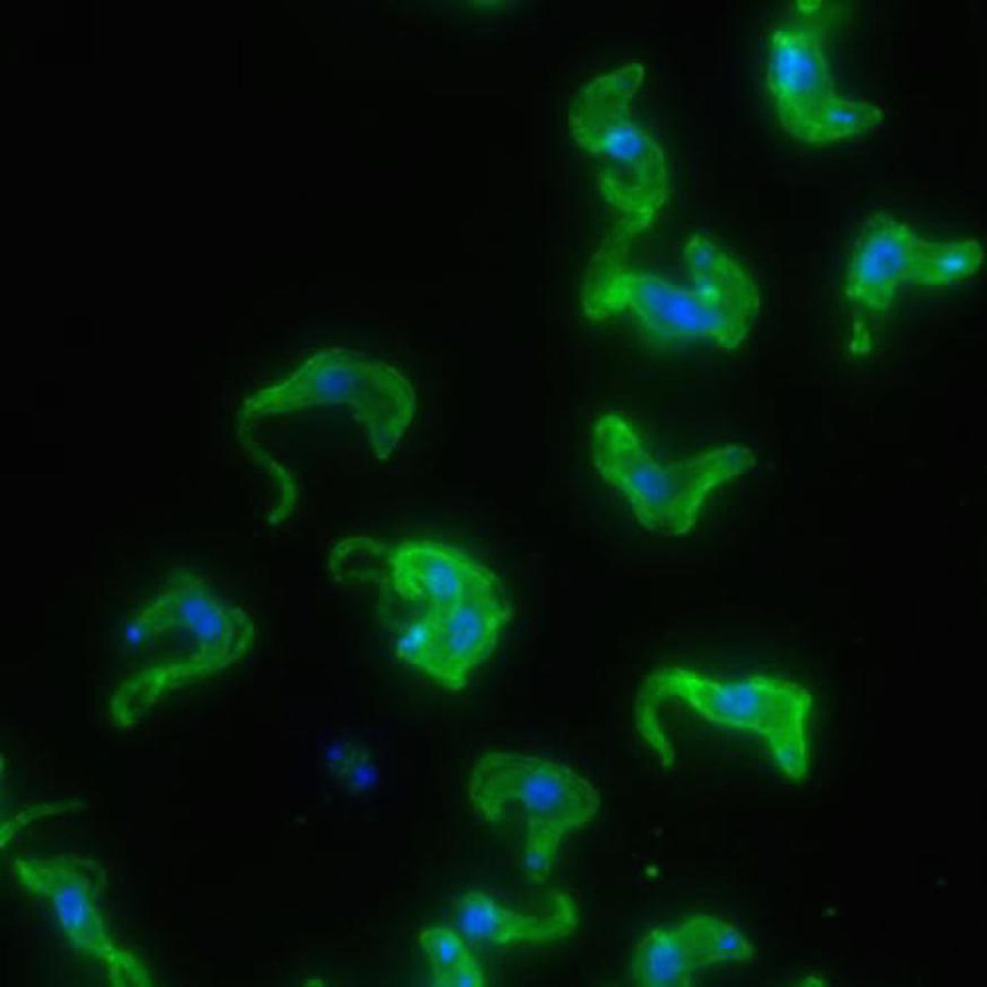 Microscopy image of Trypanosoma brucei, the African sleeping sickness parasite