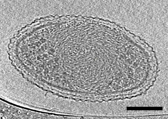 This cryo-electron tomography image reveals the internal structure of an ultra-small bacteria cell like never before. The cell has a very dense interior compartment and a complex cell wall. The darker spots at each end of the cell are most likely ribosomes. The image was obtained from a 3-D reconstruction. The scale bar is 100 nanometers.