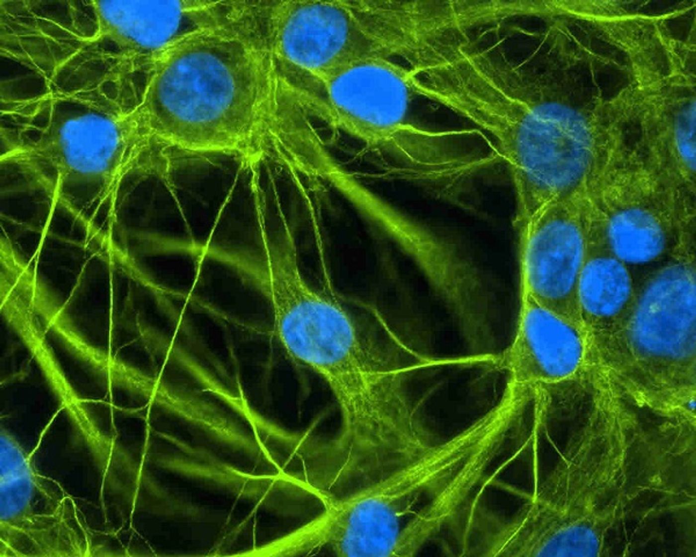 Brain astrocyte cells