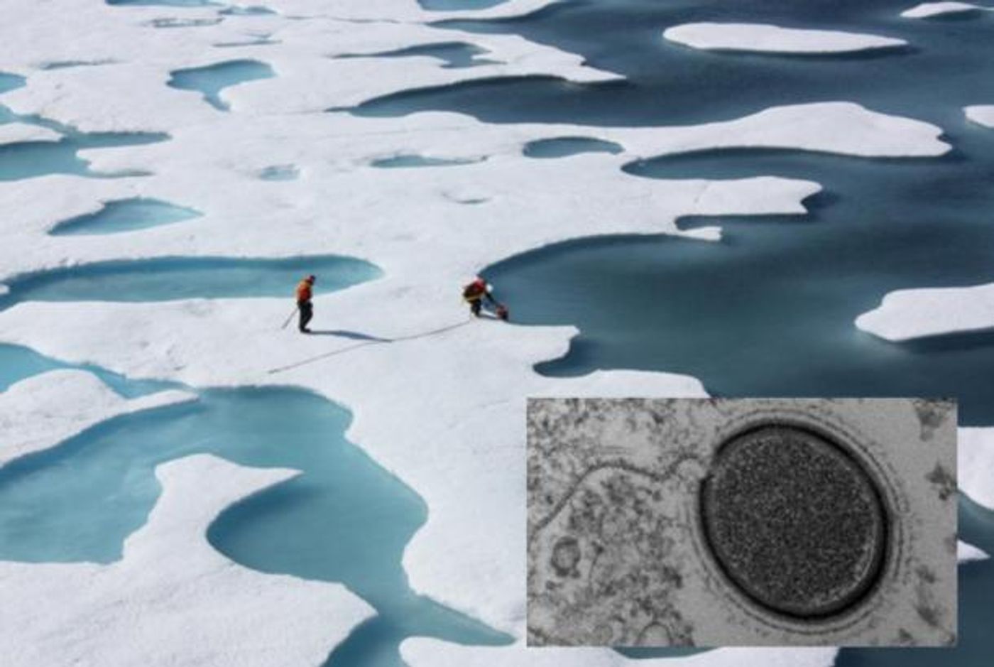 Melting soils of the arctic and an electron micrograph of M. sibericum