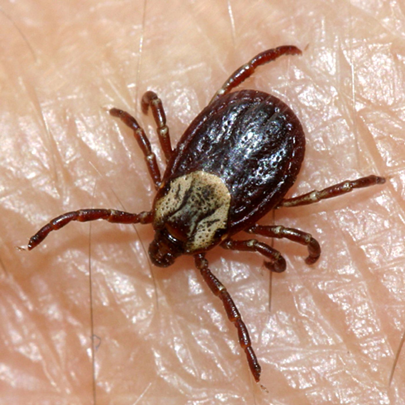 The American dog tick is known to transmit Rocky Mountain Spotted Fever in 5 American states.