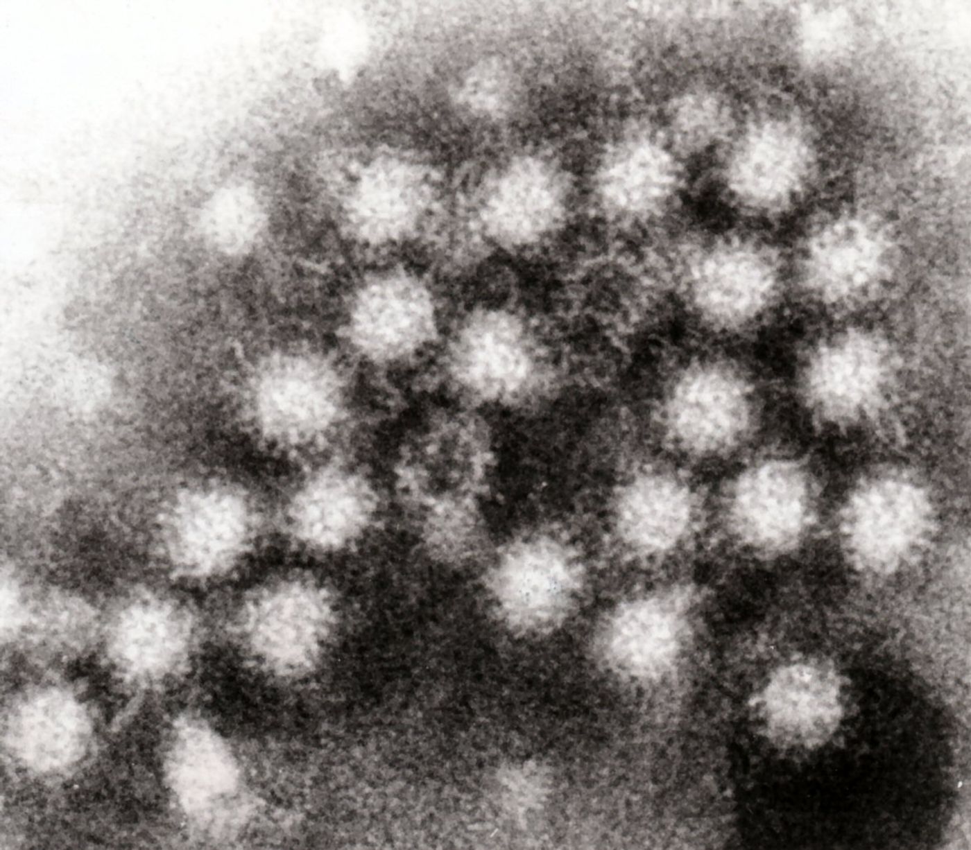 Aerosolized norovirus particles can be found within 1 meter of an infected patients room.