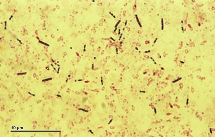Bacillus subtilis bacteria Bacillus subtilis bacteria