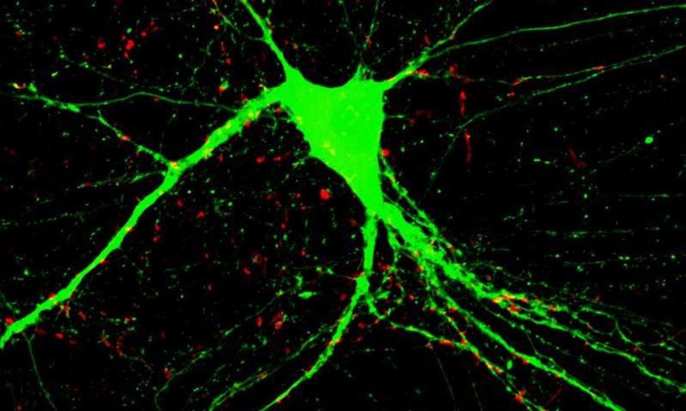 Abnormal behavior of two genes causes schizophrenia.