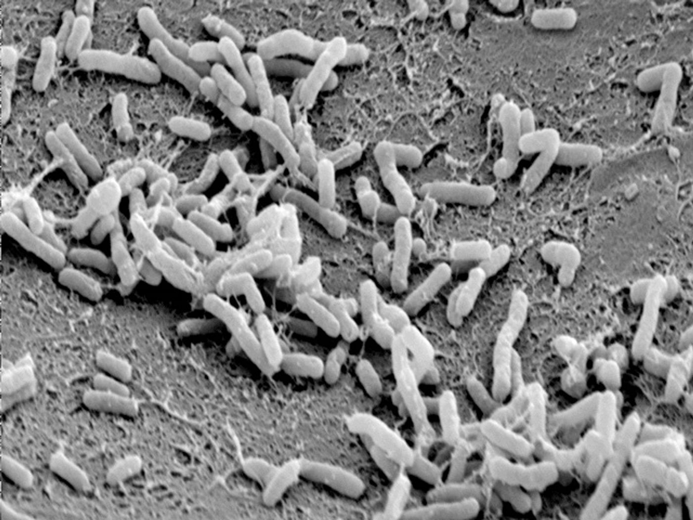 Agrobacterium tumefaciens is a Gram negative, soil dwelling bacterium.
