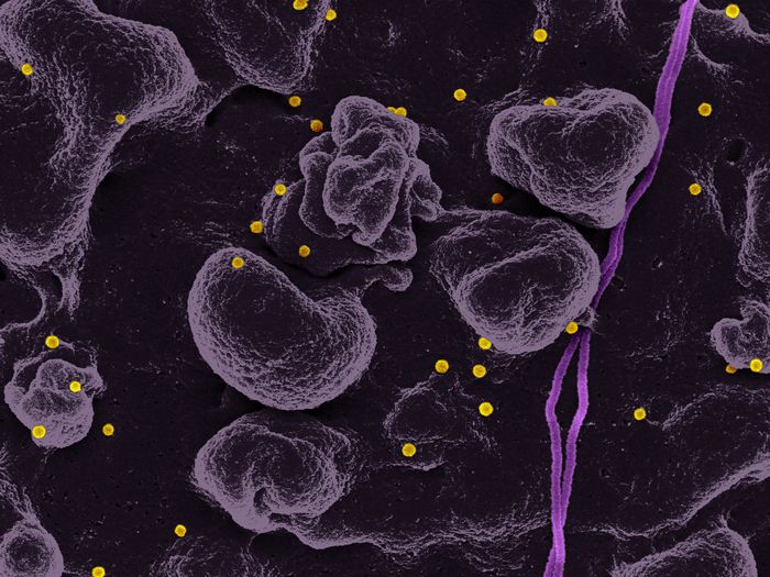   Scanning electron micrograph of Crimean-Congo hemorrhagic fever (CCHF) viral particles (yellow) budding from the surface of cultured epithelial cells from a patient. Credit: NIAID
