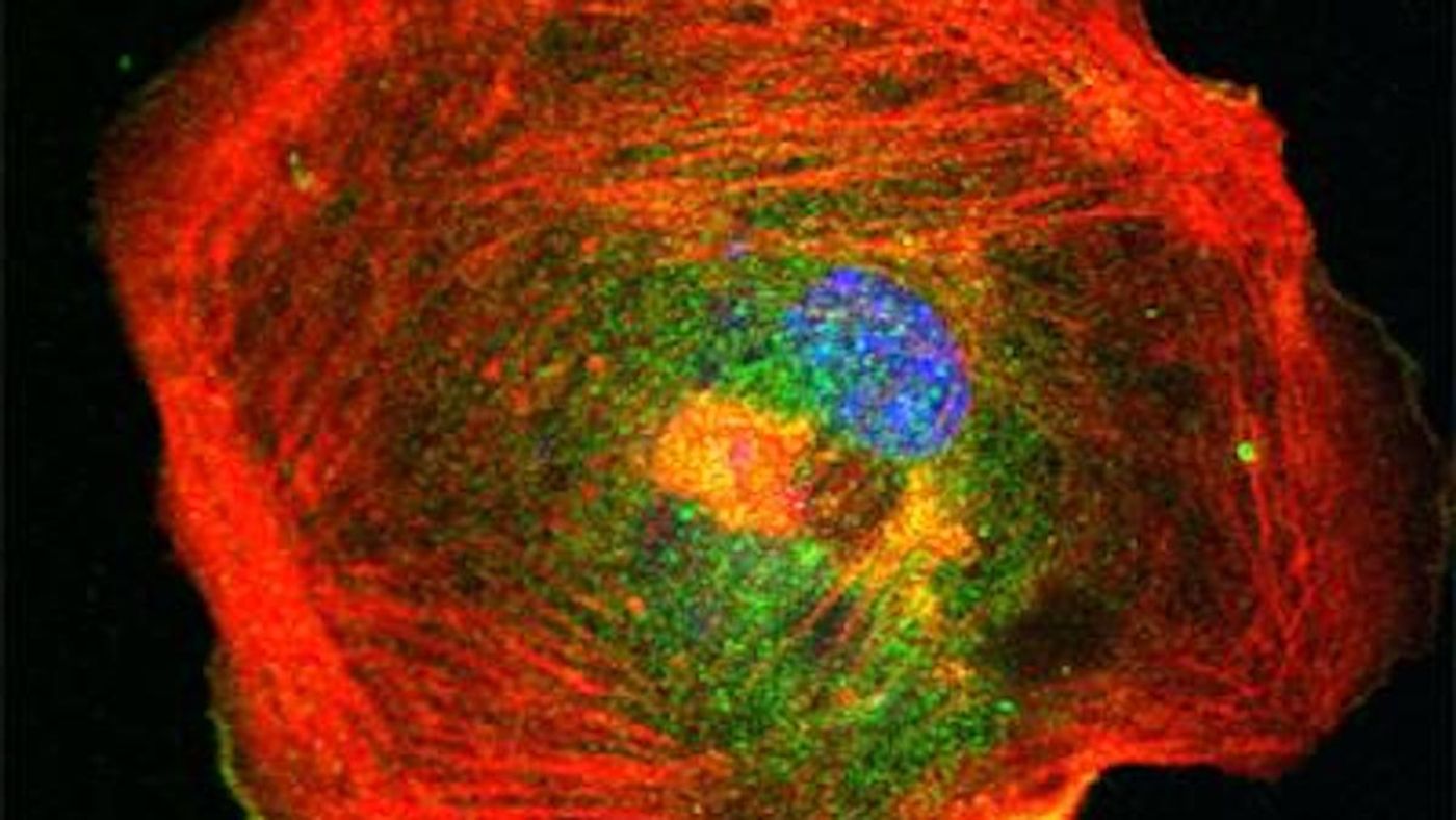 In this view of a cell, cropped from an image courtesy of Dr. Praveen Suraneni, Actin is shown in red