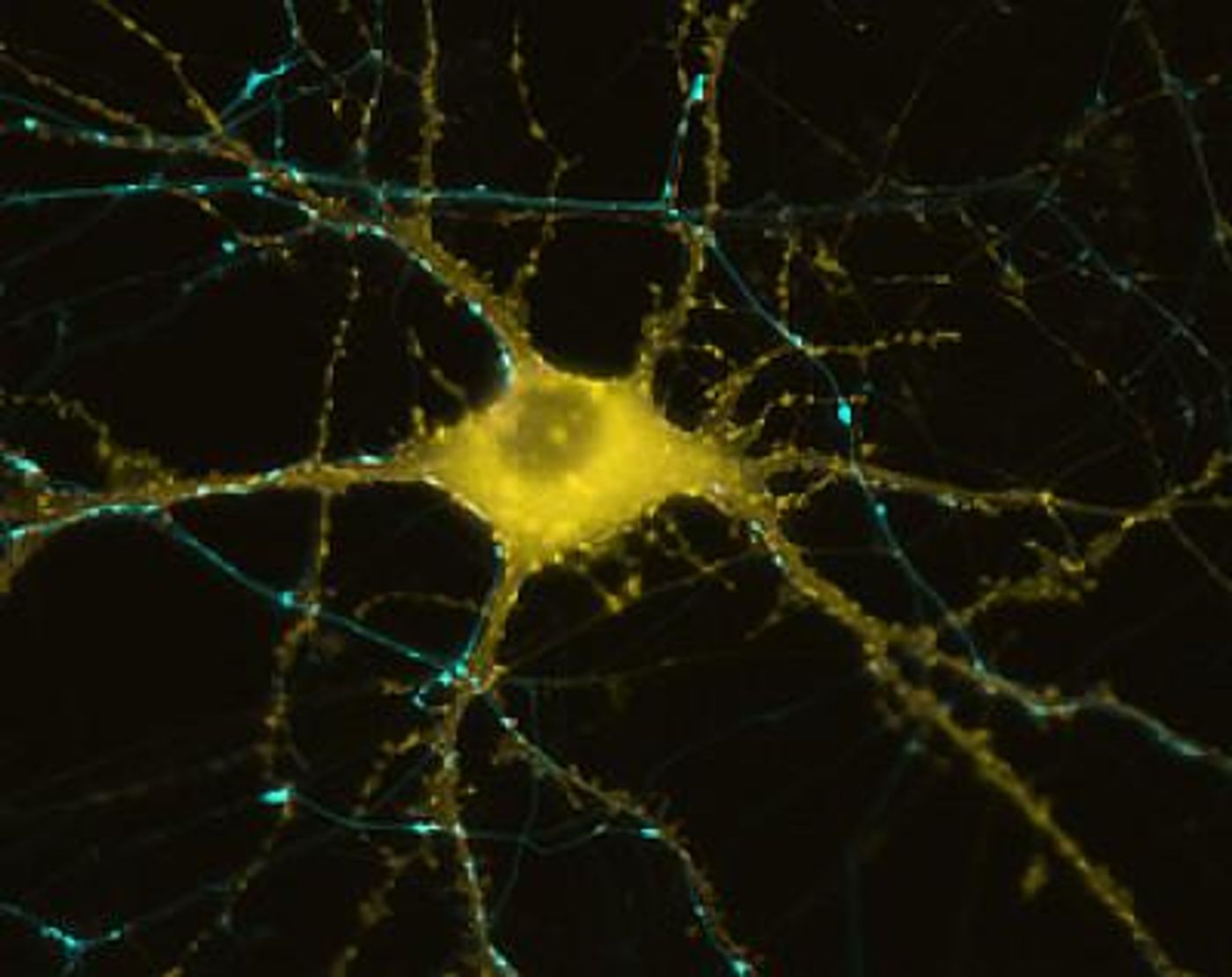 A human neuron. / Credit: UC San Diego School of Medicine