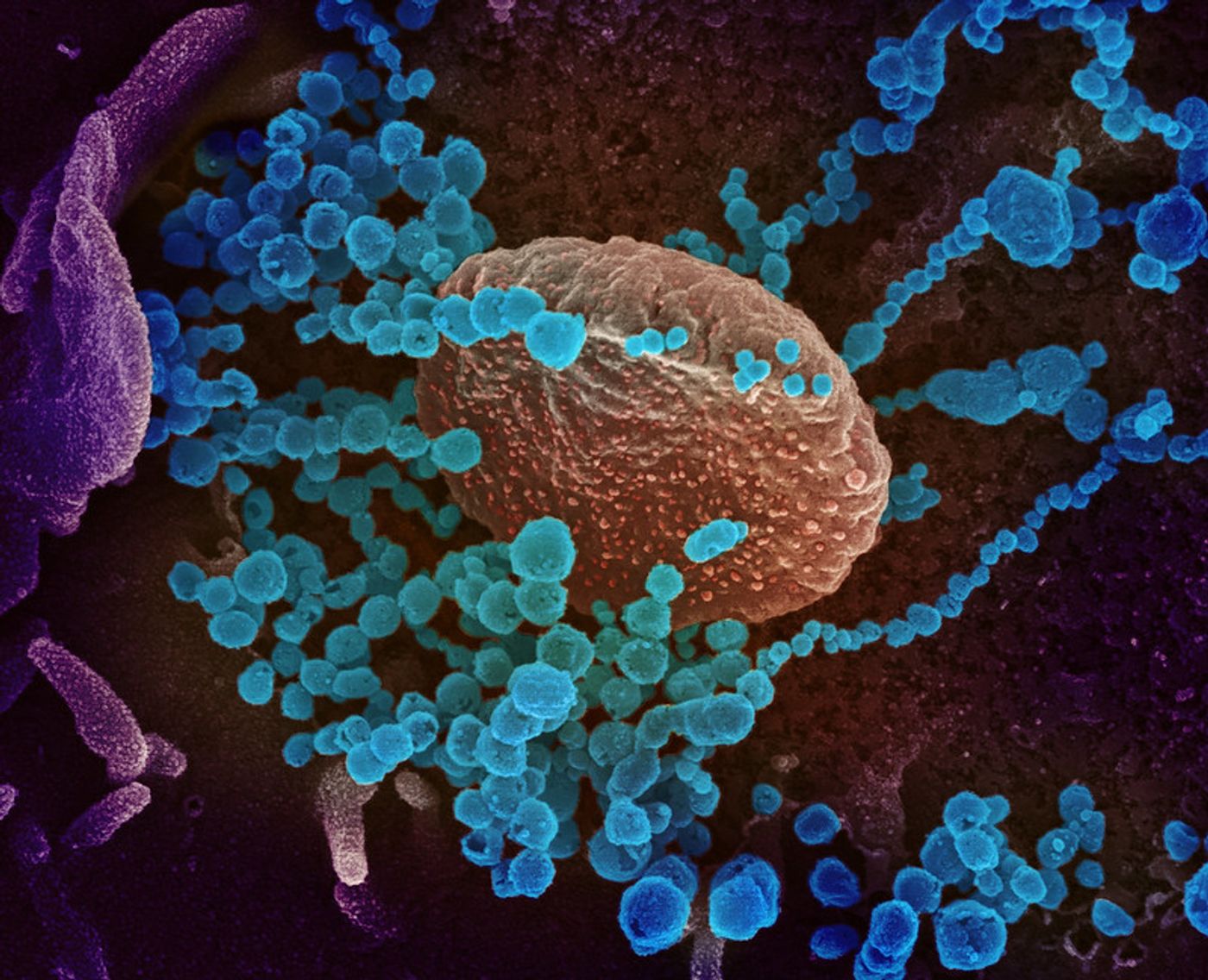 This scanning electron microscope image shows SARS-CoV-2 (round blue objects) emerging from the surface of cells cultured in the lab. SARS-CoV-2, also known as 2019-nCoV, is the virus that causes COVID-19. The virus shown was isolated from a patient in the U.S. Image captured and colorized at NIAID's Rocky Mountain Laboratories (RML) in Hamilton, Montana. / Credit: NIAID
