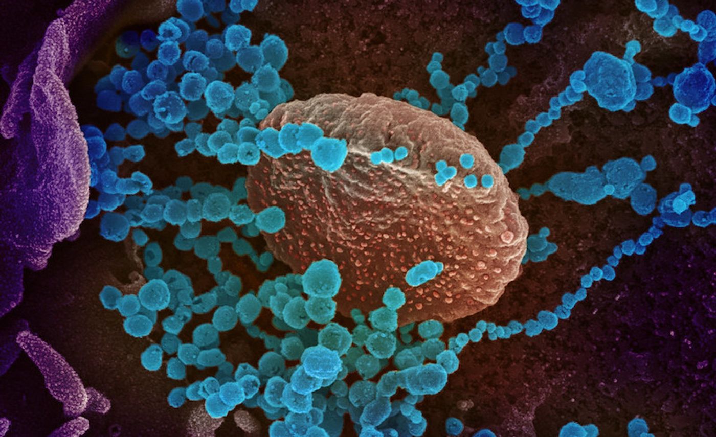 This SEM image shows SARS-CoV-2 (round blue objects) emerging from the surface of cells cultured in the lab. The virus shown was isolated from a patient in the U.S. / Image credit: cropped from NIAID/Rocky Mountain Laboratories (RML) in Hamilton, Montana