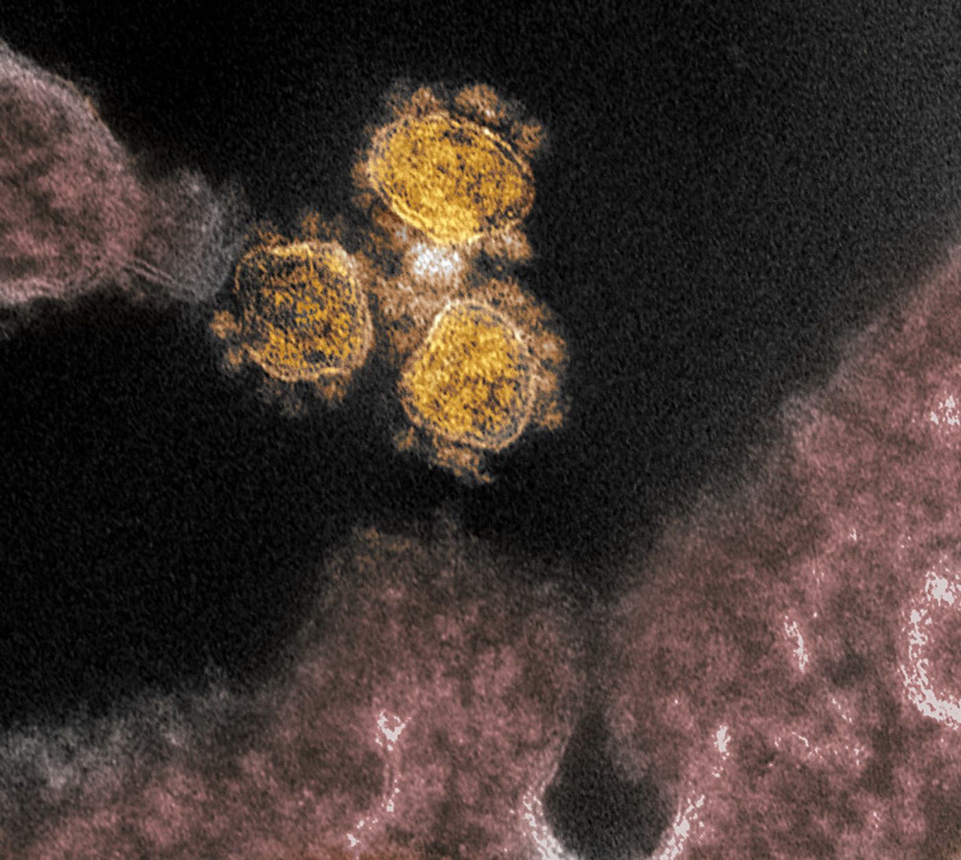 This transmission electron microscope image shows SARS-CoV-2, the virus that causes COVID-19, isolated from a patient in the U.S. Virus particles (round gold objects) are shown emerging from the surface of cells cultured in the lab. The spikes on the outer edge of the virus particles give coronaviruses their name, crown-like. Image captured and colorized at NIAID's Rocky Mountain Laboratories (RML) in Hamilton, Montana. / Credit: NIAID
