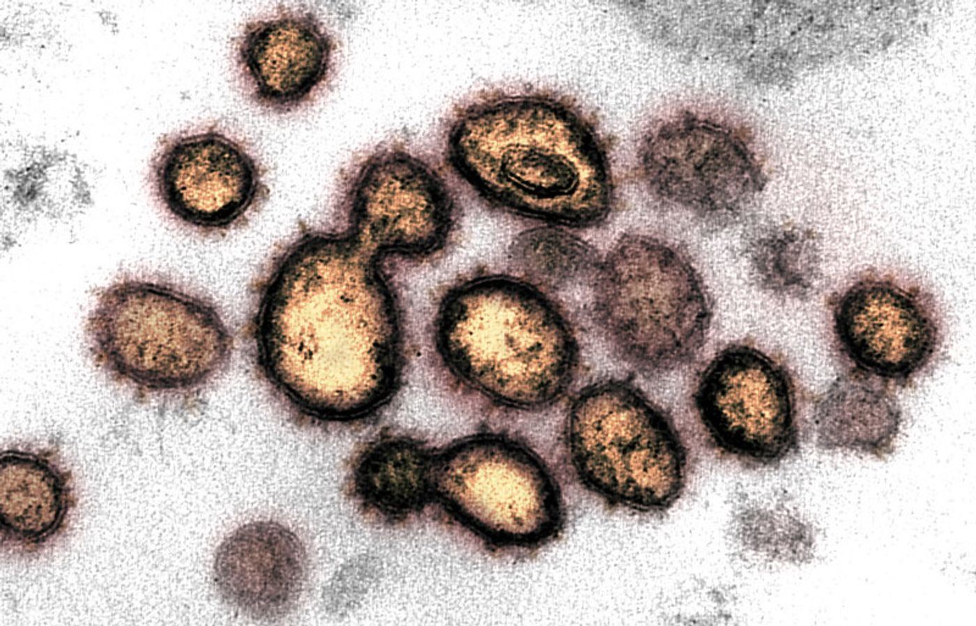 This transmission electron microscope image shows SARS-CoV-2, the virus that causes COVID-19, isolated from a patient in the U.S. Virus particles are shown emerging from the surface of cells cultured in the lab. The spikes on the outer edge of the virus particles give coronaviruses their name, crown-like. / Credit: NIAID-RML