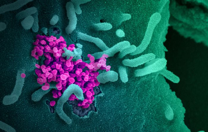 This scanning electron microscope image shows SARS-CoV-2 (round magenta objects) emerging from the surface of cells cultured in the lab. SARS-CoV-2, also known as 2019-nCoV, is the virus that causes COVID-19. The virus shown was isolated from a patient in the U.S. Image captured and colorized at NIAID's Rocky Mountain Laboratories (RML) in Hamilton, Montana. Credit: NIAID