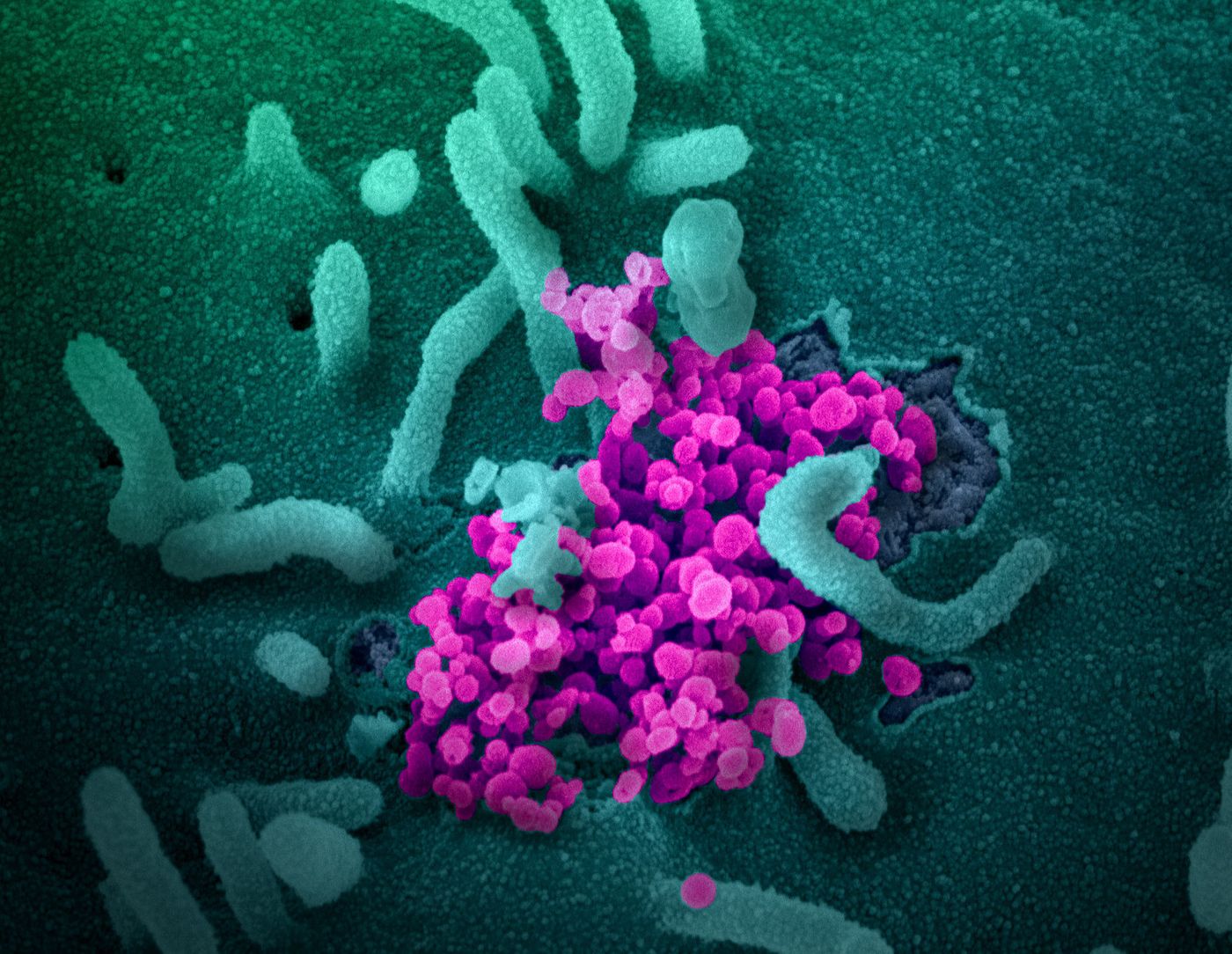 This scanning electron microscope image shows SARS-CoV-2 (round magenta objects) emerging from the surface of cells cultured in the lab. SARS-CoV-2, also known as 2019-nCoV, is the virus that causes COVID-19. The virus shown was isolated from a patient in the U.S. / Credit: NIAID-RML