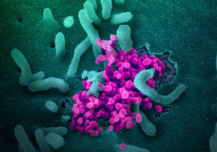 This scanning electron microscope image shows SARS-CoV-2 (round magenta objects) emerging from the surface of cells cultured in the lab. SARS-CoV-2, also known as 2019-nCoV, is the virus that causes COVID-19. The virus shown was isolated from a patient in the U.S. / Credit: NIAID-RML