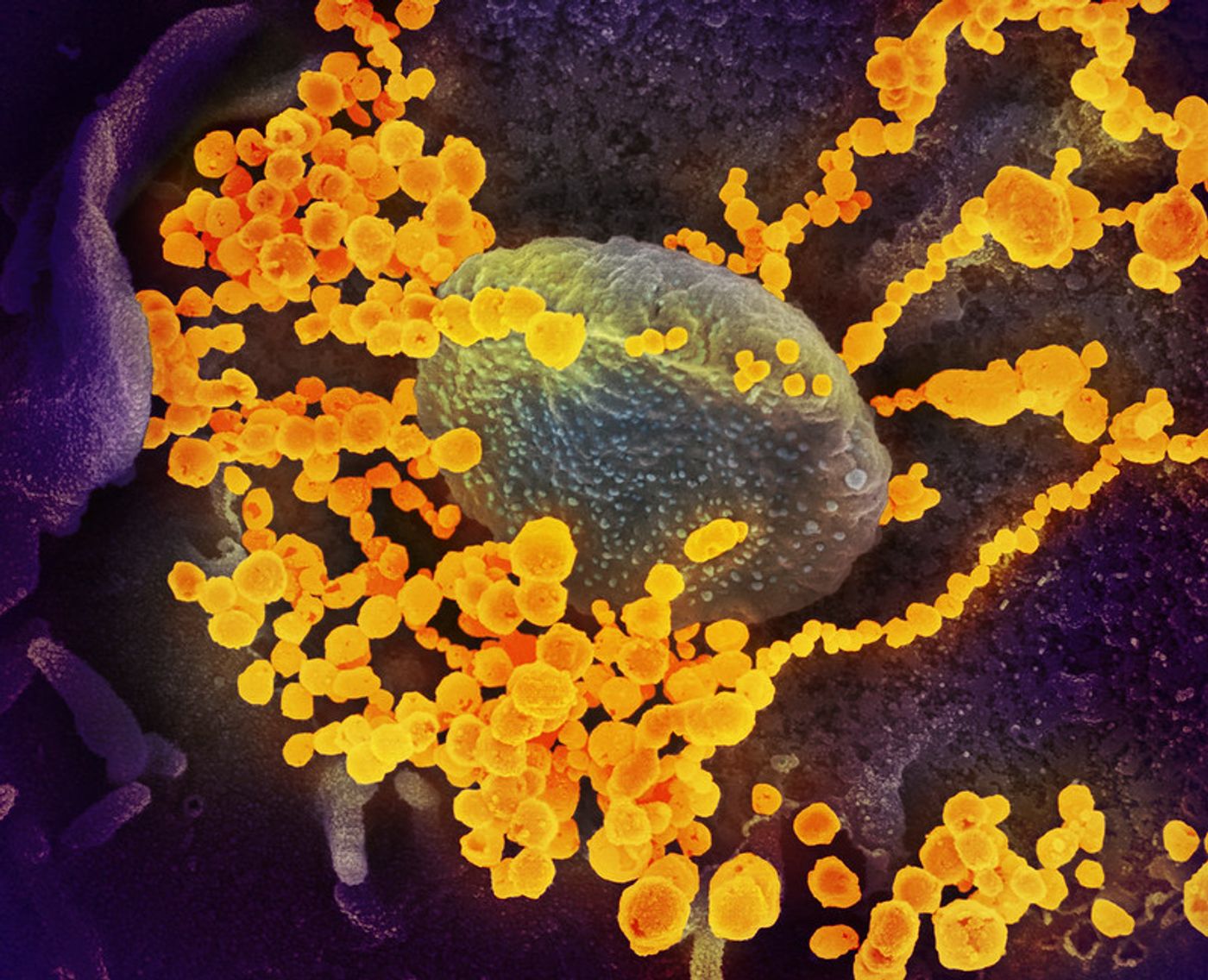 This scanning electron microscope image shows SARS-CoV-2 (round gold objects) emerging from the surface of cells cultured in the lab. SARS-CoV-2, also known as 2019-nCoV, is the virus that causes COVID-19. The virus shown was isolated from a patient in the U.S. / Credit: NIAID-RML