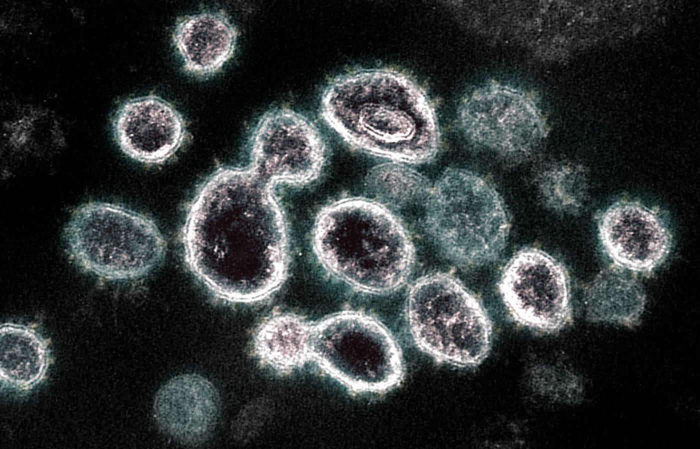 This transmission electron microscope image shows SARS-CoV-2, the virus that causes COVID-19, isolated from a patient in the U.S. Virus particles are shown emerging from the surface of cells cultured in the lab. The spikes on the outer edge of the virus particles give coronaviruses their name, crown-like. Image captured and colorized at NIAID's Rocky Mountain Laboratories (RML) in Hamilton, Montana. Credit: NIAID