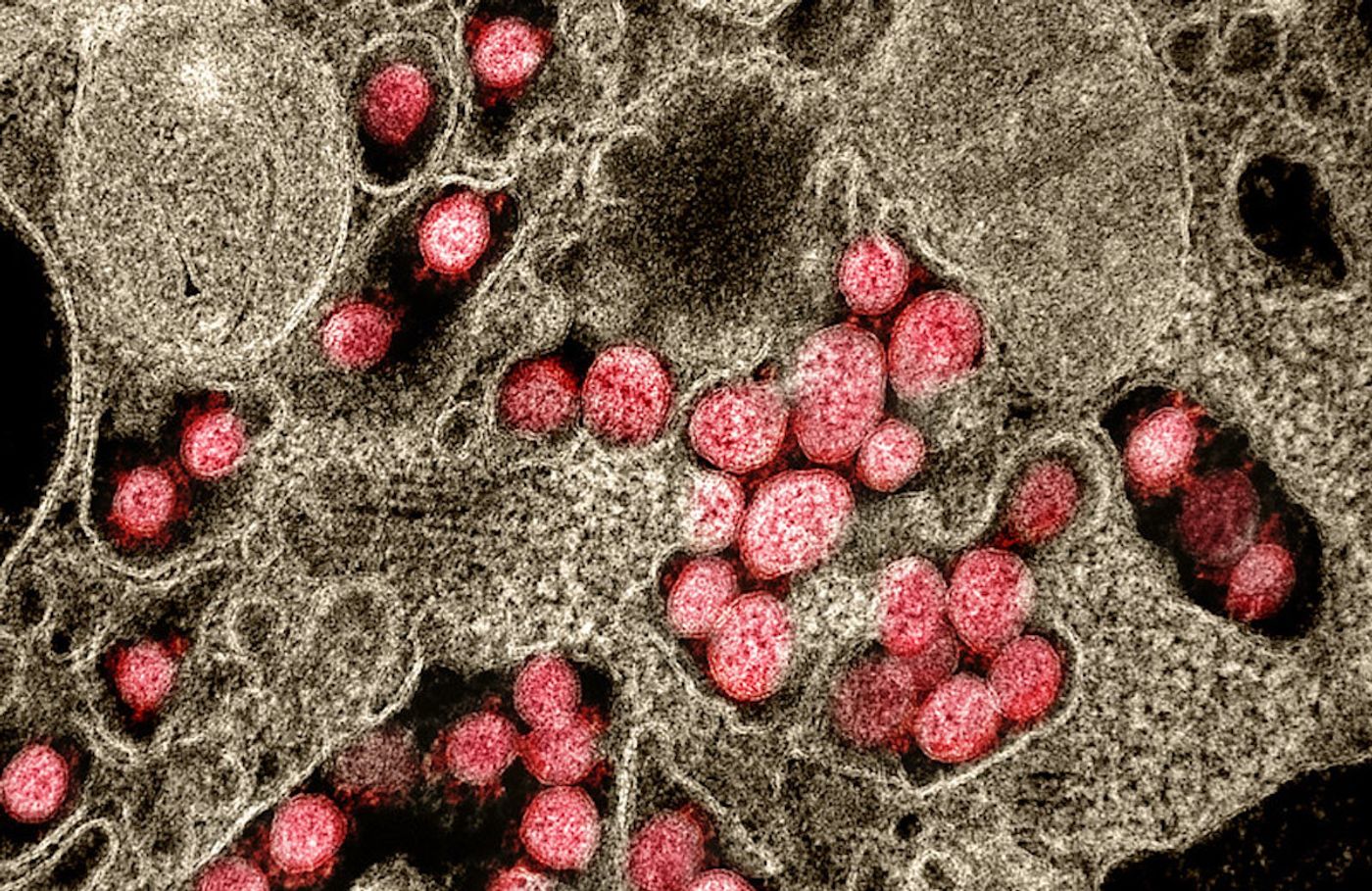 Transmission electron micrograph of SARS-CoV-2 virus particles, isolated from a patient. Image captured and color-enhanced at the NIAID Integrated Research Facility (IRF) in Fort Detrick, Maryland. / Credit: NIAID