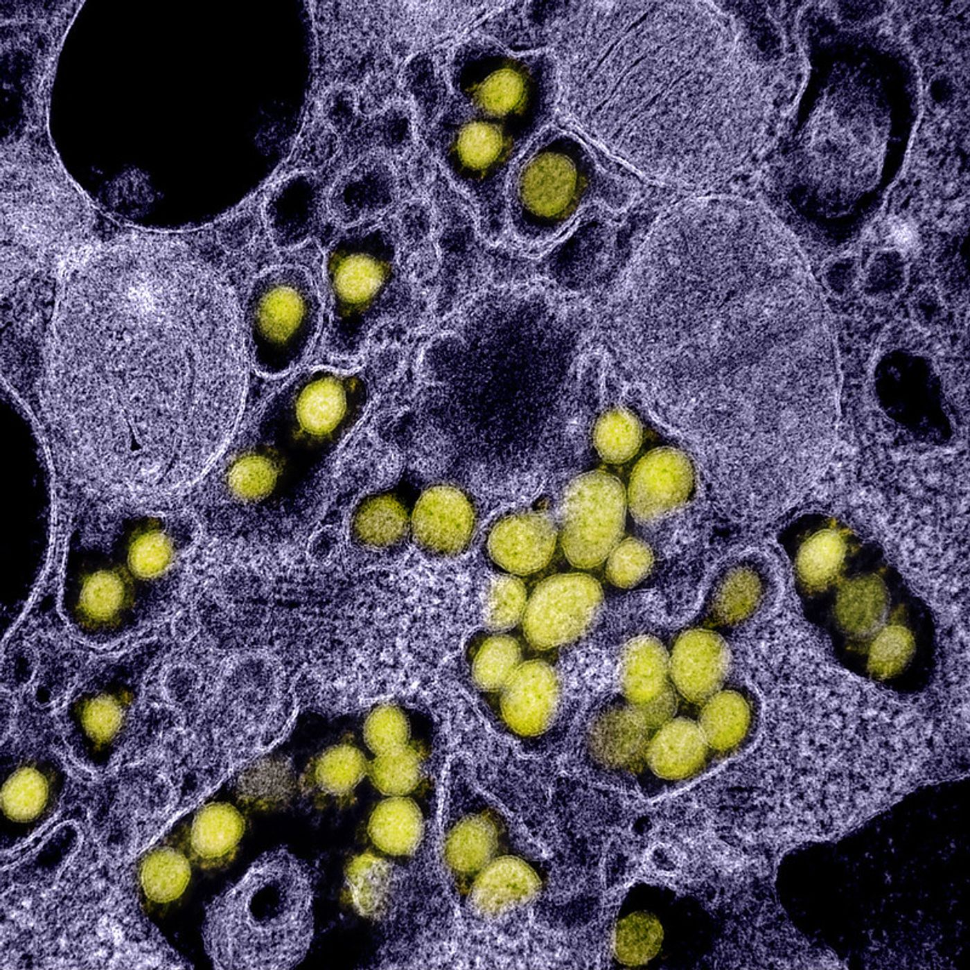 Transmission electron micrograph of SARS-CoV-2 virus particles, isolated from a patient. Image captured and color-enhanced at the NIAID Integrated Research Facility (IRF) in Fort Detrick, Maryland. Credit: NIAID