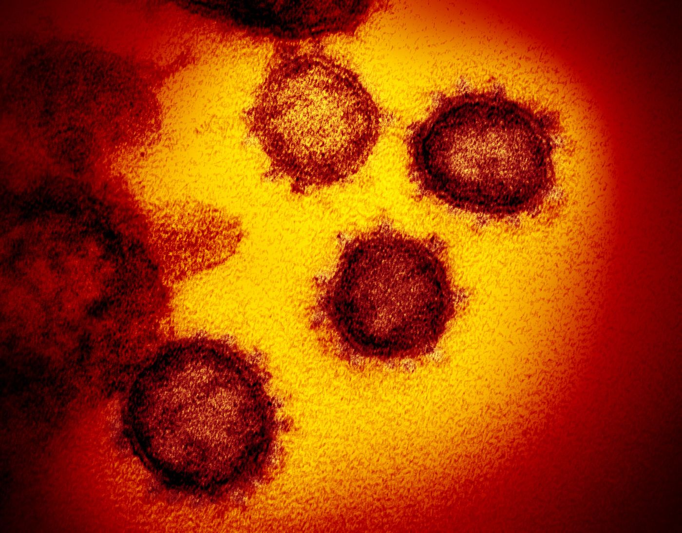 Novel Coronavirus SARS-CoV-2  This transmission electron microscope image shows SARS-CoV-2-also known as 2019-nCoV, the virus that causes COVID-19. isolated from a patient in the U.S., emerging from the surface of cells cultured in the lab. / Credit: NIAID-RML