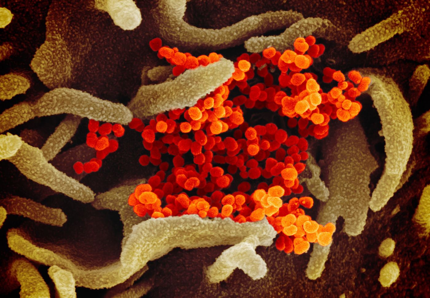 This scanning electron microscope image shows SARS-CoV-2 (orange)-also known as 2019-nCoV, the virus that causes COVID-19-isolated from a patient in the U.S., emerging from the surface of cells (green) cultured in the lab. / Credit: NIAID-RML