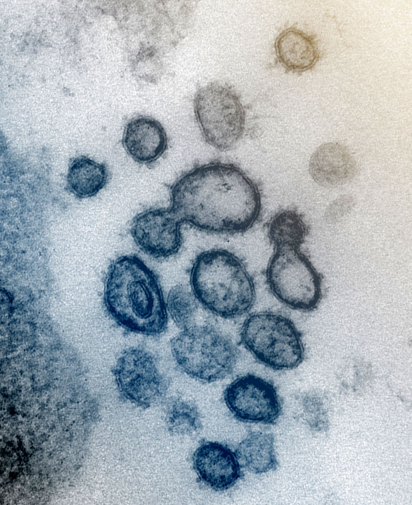 This transmission electron microscope image shows SARS-CoV-2-also known as 2019-nCoV, the virus that causes COVID-19-isolated from a patient in the U.S. Virus particles are shown emerging from the surface of cells cultured in the lab. The spikes on the outer edge of the virus particles give coronaviruses their name, crown-like. / Credit: NIAID-RML