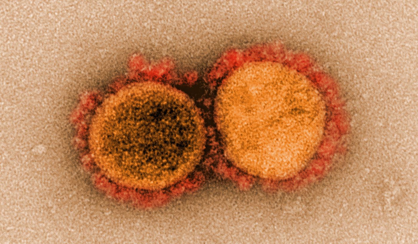 Transmission electron micrograph of SARS-CoV-2 virus particles, isolated from a patient. Image captured and color-enhanced at the NIAID Integrated Research Facility (IRF) in Fort Detrick, Maryland. / Credit: NIAID