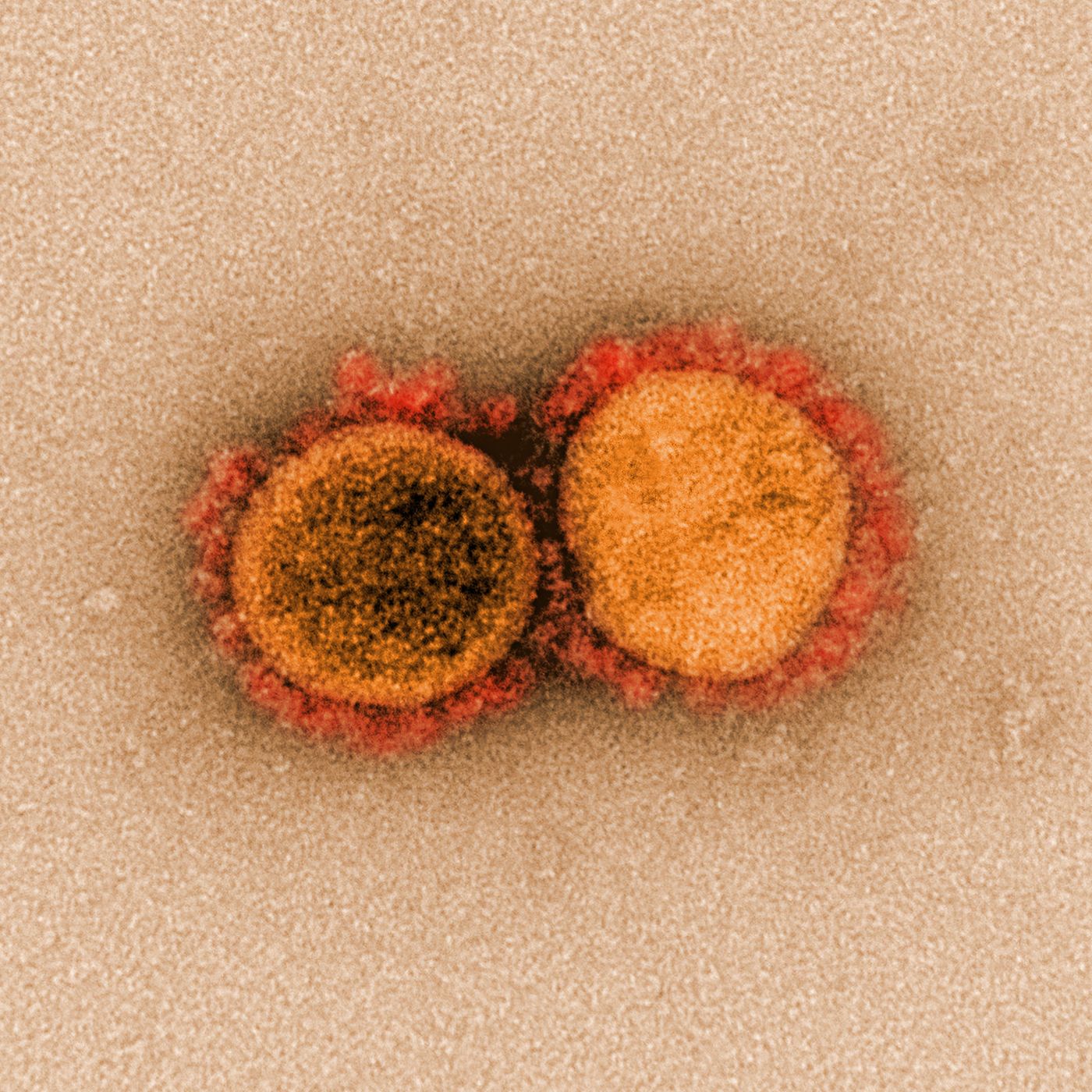 Transmission electron micrograph of SARS-CoV-2 virus particles, isolated from a patient. Image captured and color-enhanced at the NIAID Integrated Research Facility (IRF) in Fort Detrick, Maryland. Credit: NIAID