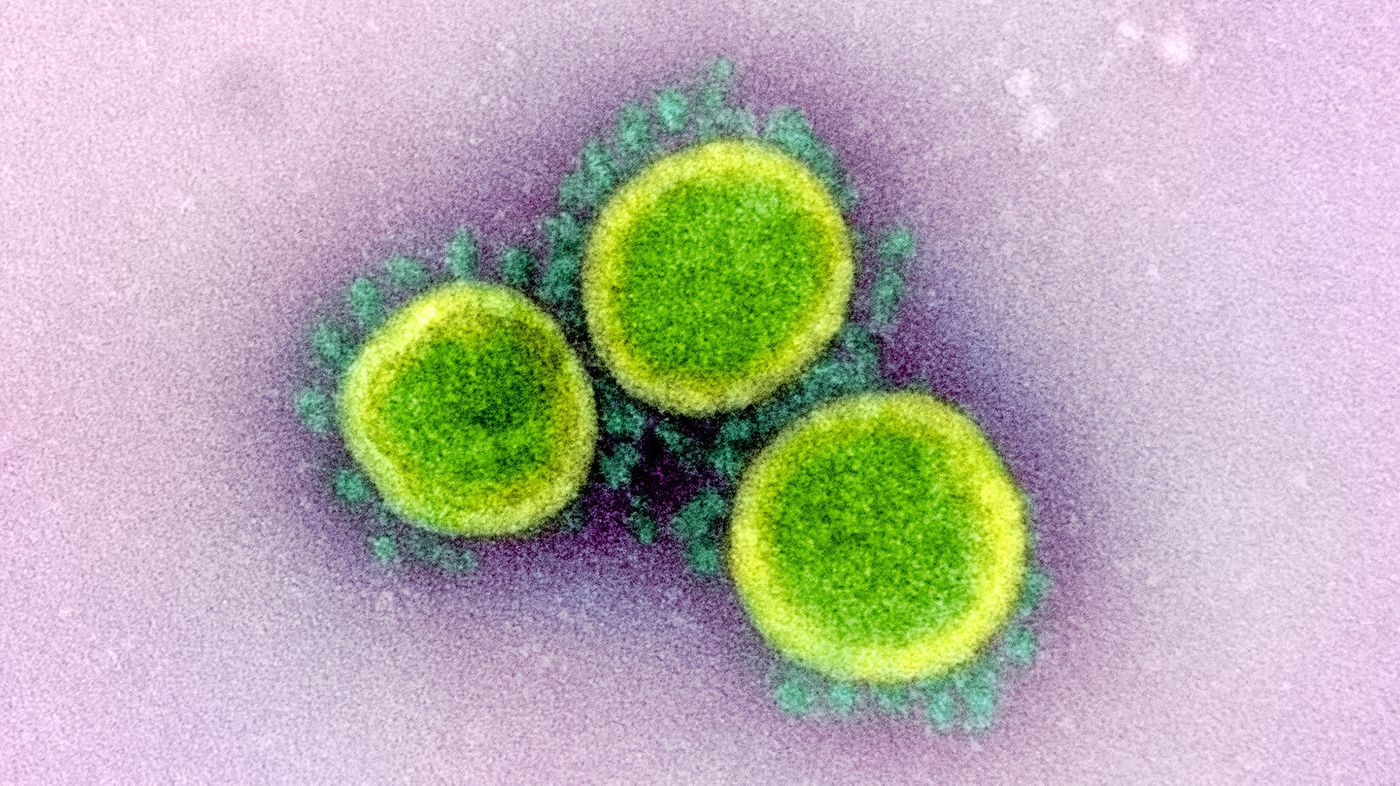 Transmission electron micrograph of SARS-CoV-2 virus particles, isolated from a patient. Image captured and color-enhanced at the NIAID Integrated Research Facility (IRF) in Fort Detrick, Maryland. / Credit: NIAID