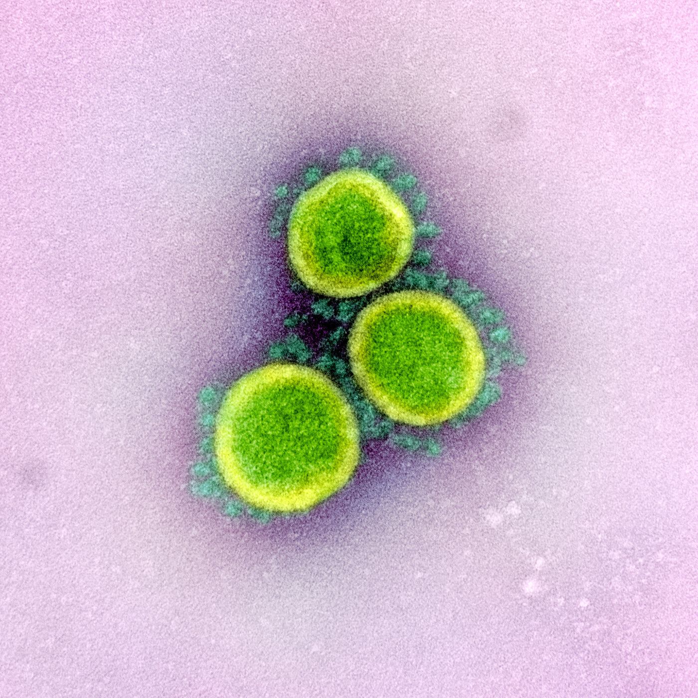 Transmission electron micrograph of SARS-CoV-2 virus particles, isolated from a patient. Image captured and color-enhanced at the NIAID Integrated Research Facility (IRF) in Fort Detrick, Maryland. / Credit: NIAID