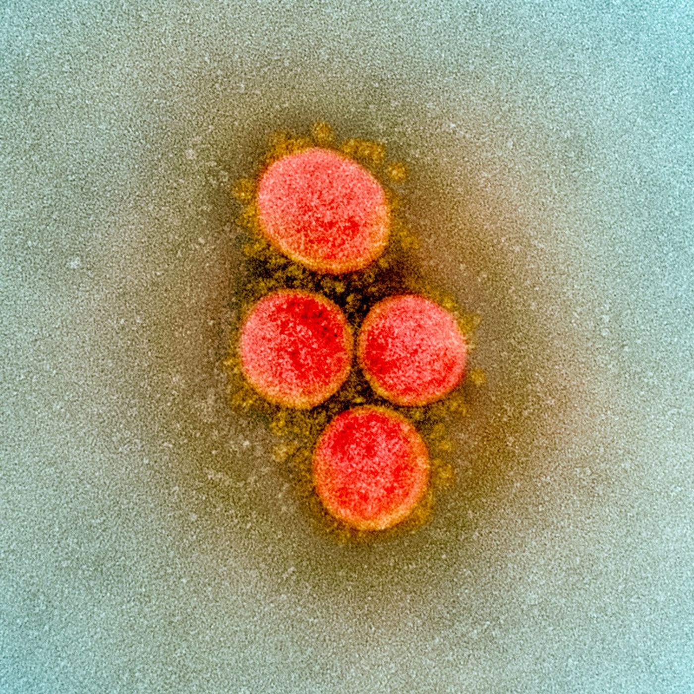 Transmission electron micrograph of SARS-CoV-2 virus particles, isolated from a patient. Image captured and color-enhanced at the NIAID Integrated Research Facility (IRF) in Fort Detrick, Maryland. / Credit: NIAID