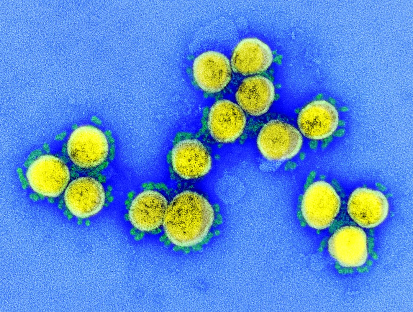 Transmission electron micrograph of SARS-CoV-2 virus particles, isolated from a patient. Image captured and color-enhanced at the NIAID Integrated Research Facility (IRF) in Fort Detrick, Maryland. Credit: NIAID