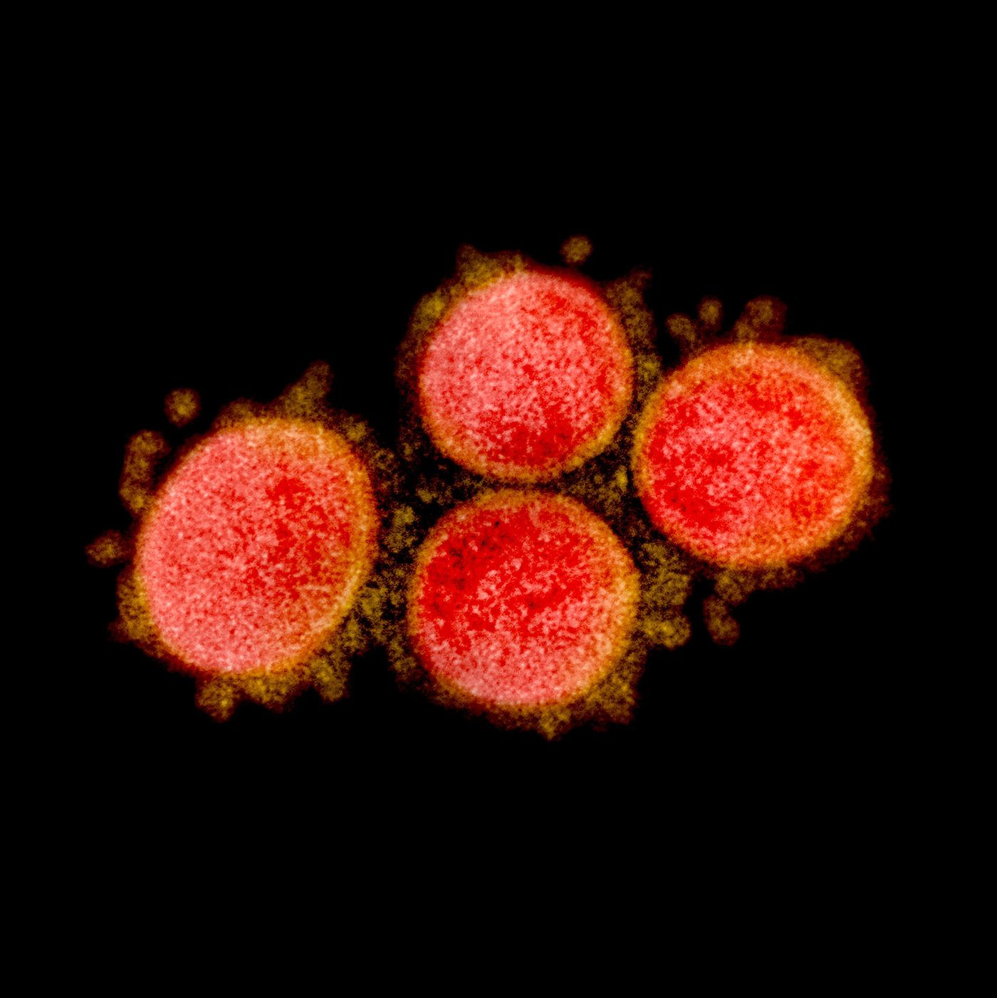 Transmission electron micrograph of SARS-CoV-2 virus particles, isolated from a patient. Image captured and color-enhanced at the NIAID Integrated Research Facility (IRF) in Fort Detrick, Maryland. Credit: NIAID