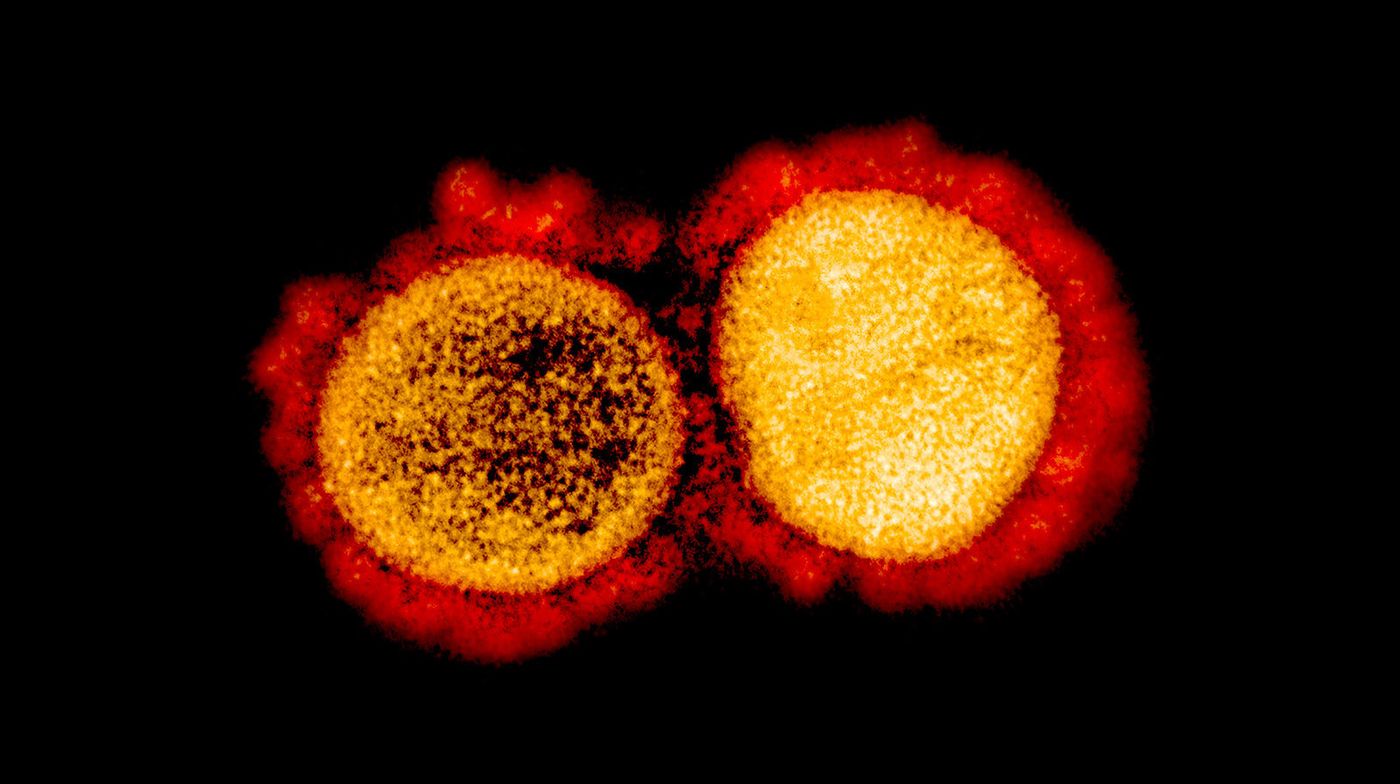 Transmission electron micrograph of SARS-CoV-2 virus particles, isolated from a patient. Image captured and color-enhanced at the NIAID Integrated Research Facility (IRF) in Fort Detrick, Maryland. / Credit: NIAID