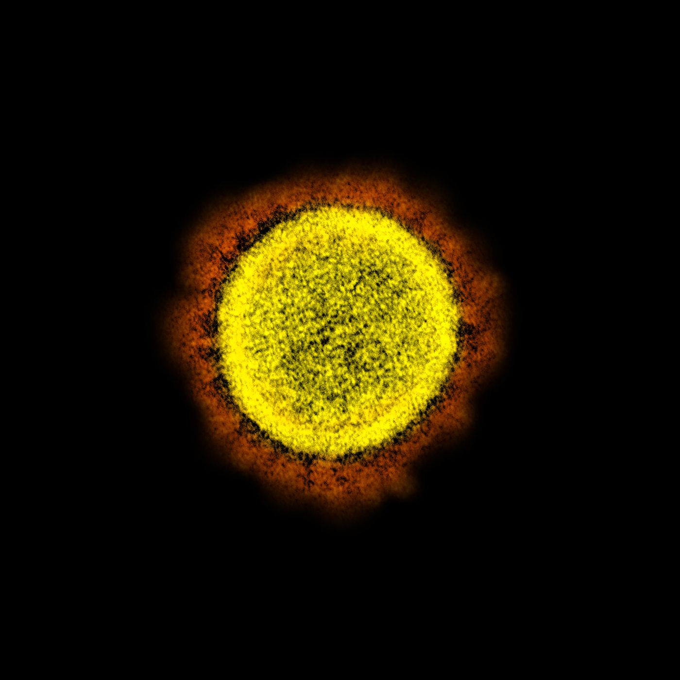 Transmission electron micrograph of SARS-CoV-2 virus particles, isolated from a patient. Image captured and color-enhanced at the NIAID Integrated Research Facility (IRF) in Fort Detrick, Maryland. / Credit: NIAID