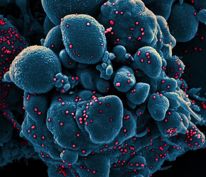 Colorized scanning electron micrograph of an apoptotic cell (blue) infected with SARS-COV-2 virus particles (red), isolated from a patient sample. Image captured at the NIAID Integrated Research Facility (IRF) in Fort Detrick, Maryland. / Credit: NIAID