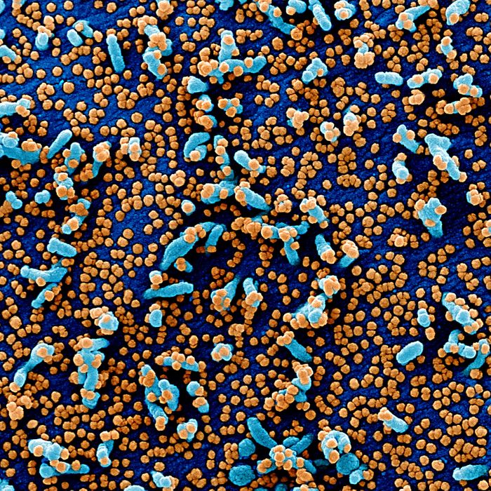 Colorized scanning electron micrograph of a VERO E6 cell (blue) heavily infected with SARS-COV-2 virus particles (orange), isolated from a patient sample. Image captured and color-enhanced at the NIAID Integrated Research Facility (IRF) in Fort Detrick, Maryland. / Credit: NIAID
