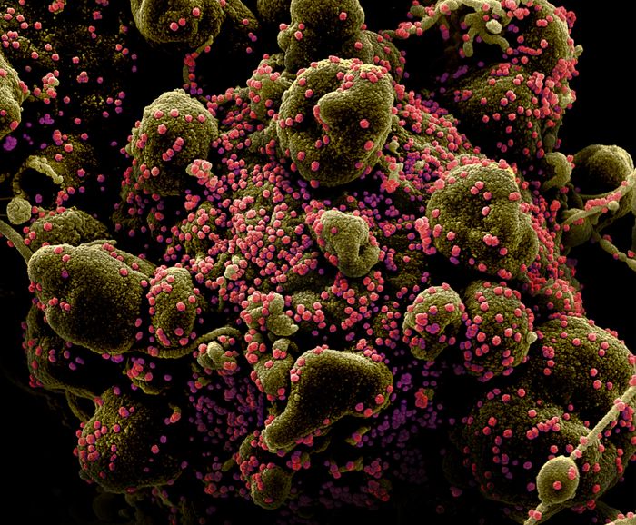Novel Coronavirus SARS-CoV-2  Colorized scanning electron micrograph of an apoptotic cell (greenish brown) heavily infected with SARS-COV-2 virus particles (pink), isolated from a patient sample. Image captured and color-enhanced at the NIAID Integrated Research Facility (IRF) in Fort Detrick, Maryland. / Credit: NIAID