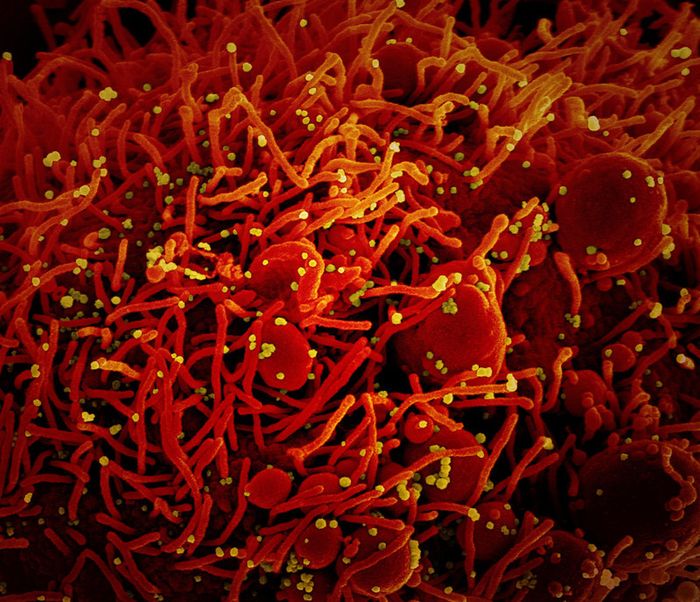 Colorized scanning electron micrograph of an apoptotic cell (red) infected with SARS-COV-2 virus particles (yellow), isolated from a patient sample. Image captured at the NIAID Integrated Research Facility (IRF) in Fort Detrick, Maryland. / Credit: NIAID